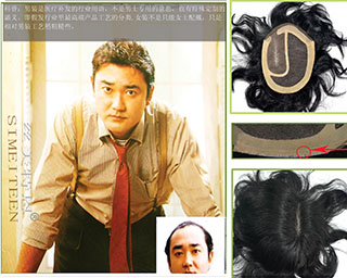 织发|织发补发|补发|补发织发|—脱发掉发,头发稀少稀疏解决专家,丝美特增发